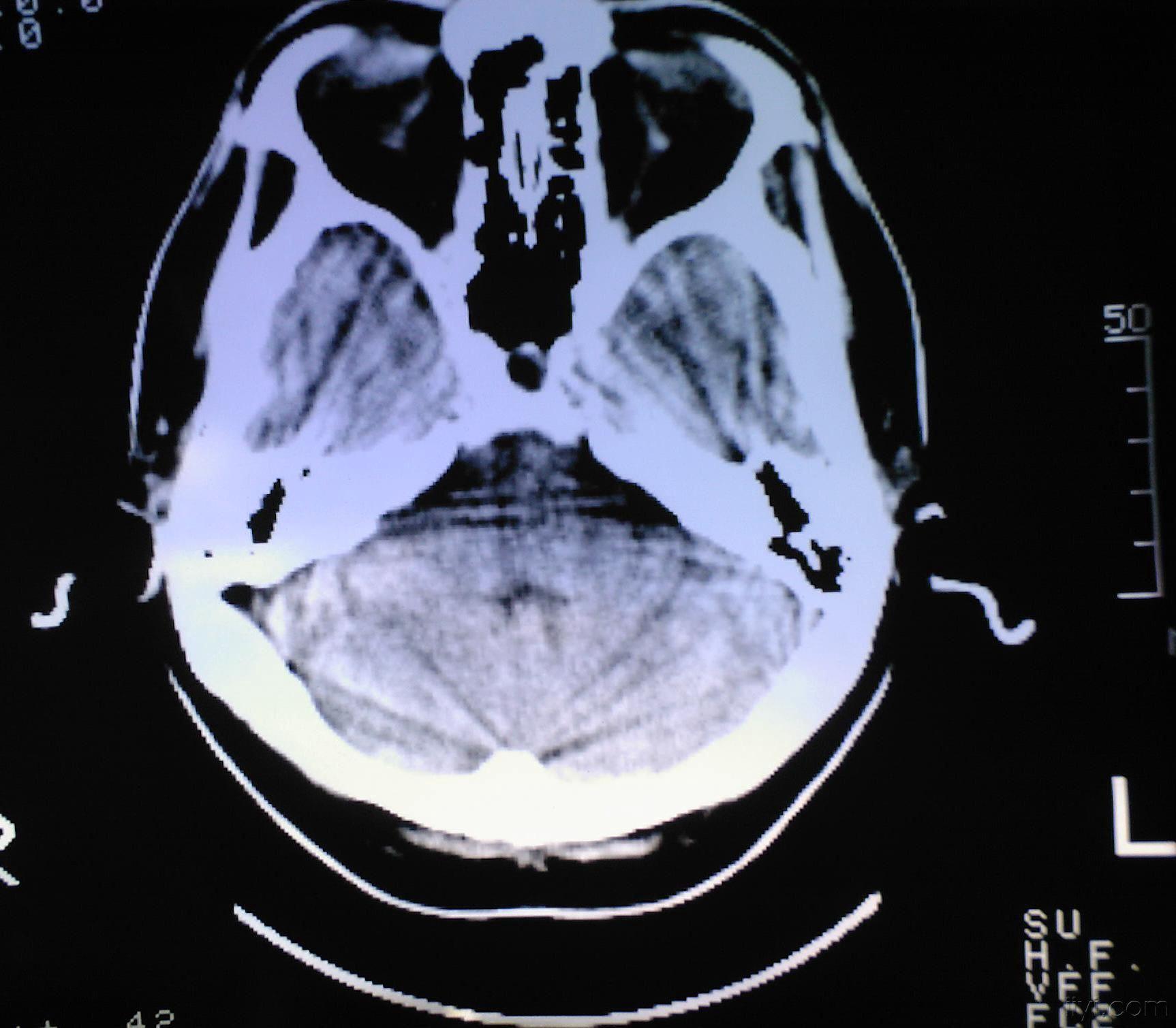 动物磁共振检查（MRI）有哪些适应症以及禁忌症？-深圳市金石医疗科技有限公司