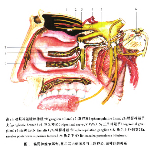 丛集性头痛1例