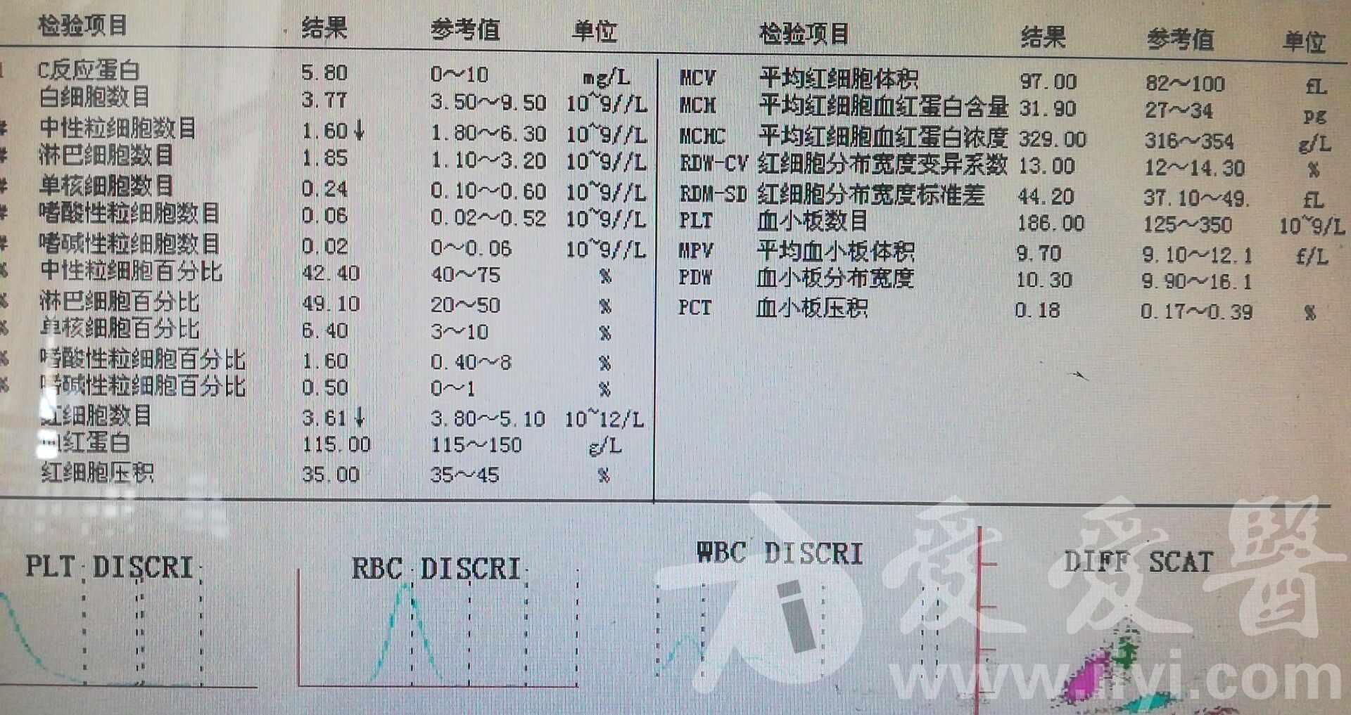 胃痉挛伴低钾血症一例