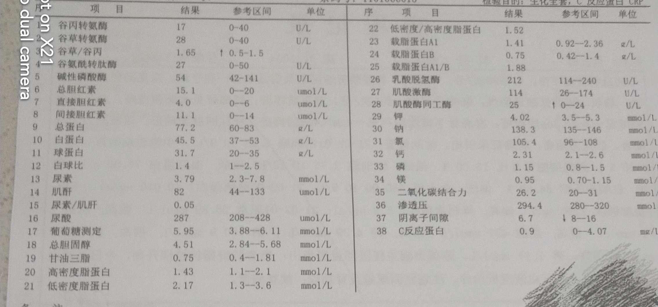 支气管扩张症,咯血的诊治