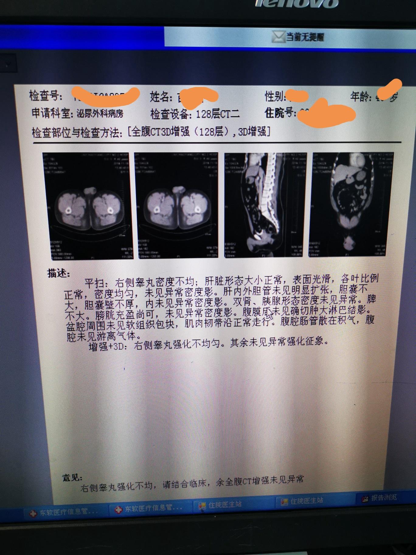 切除睾丸的手术流程_切除睾丸的手术流程是什么_北京大学第一医院_男科中心_主任医师_彭靖|视频科普| 中国医药信息查询平台
