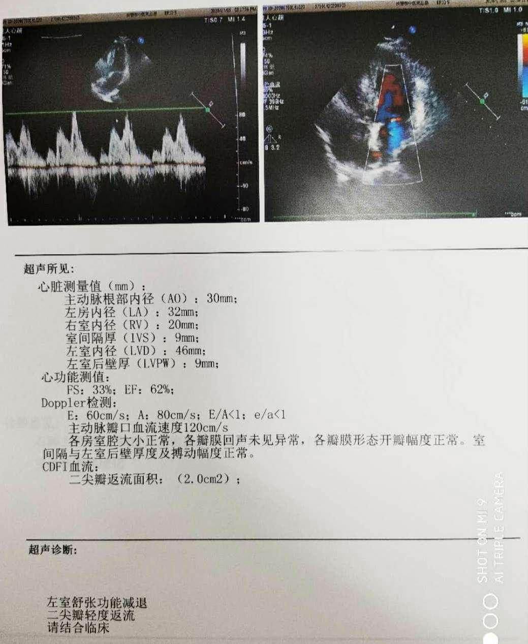 【真实案例】B超报告提示“多发性子宫肌瘤”，我该怎么办？_天津市北辰医院