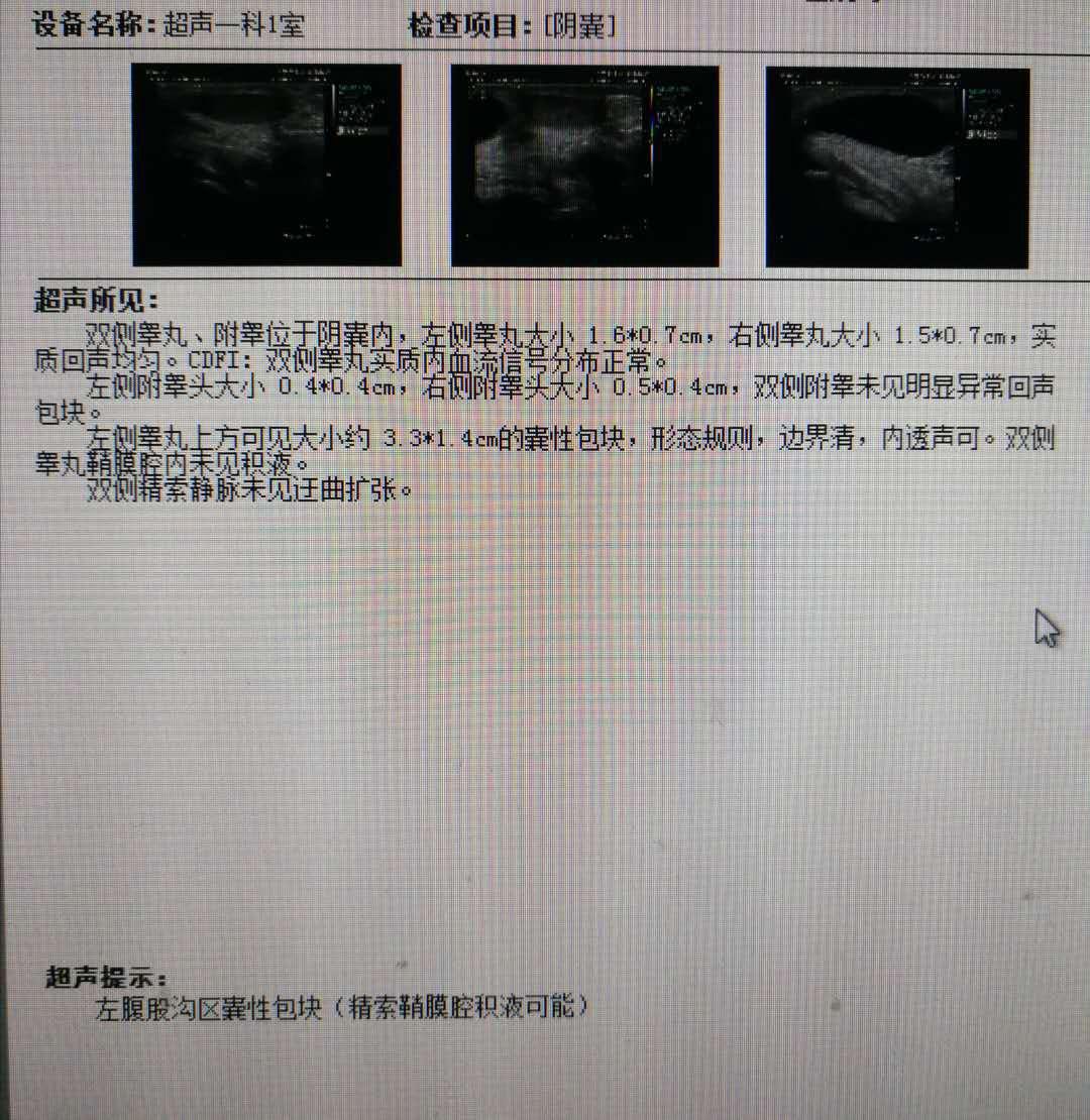 微创腔镜技术新突破：江西省儿童医院微创治疗低龄男婴双侧肾积水-医院汇-丁香园