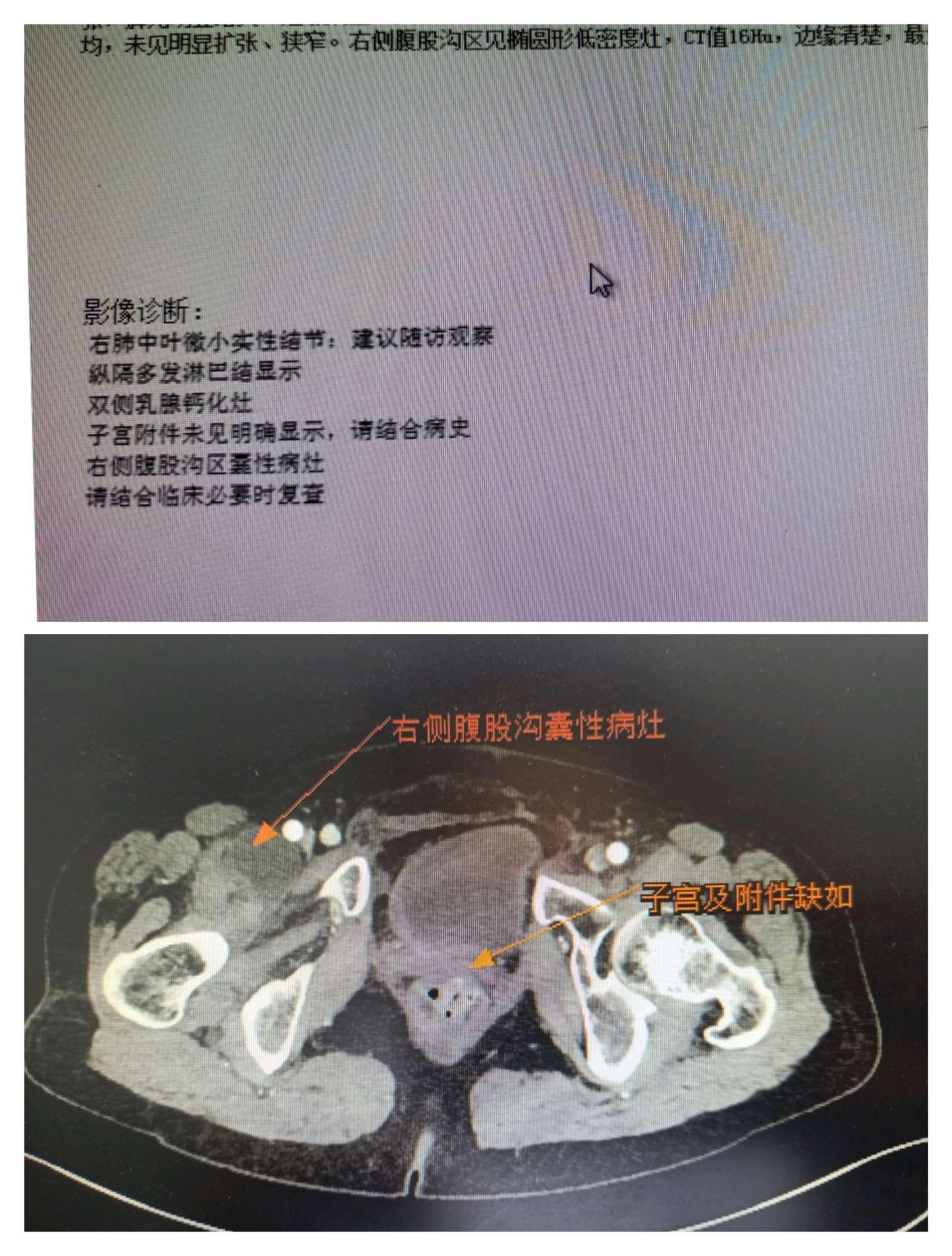术后不想留疤？经阴道手术和经阴道腹腔镜手术了解一下-新闻动态- 上海红睦房中城医院
